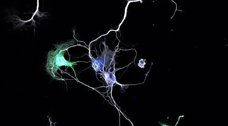 large amount of axons